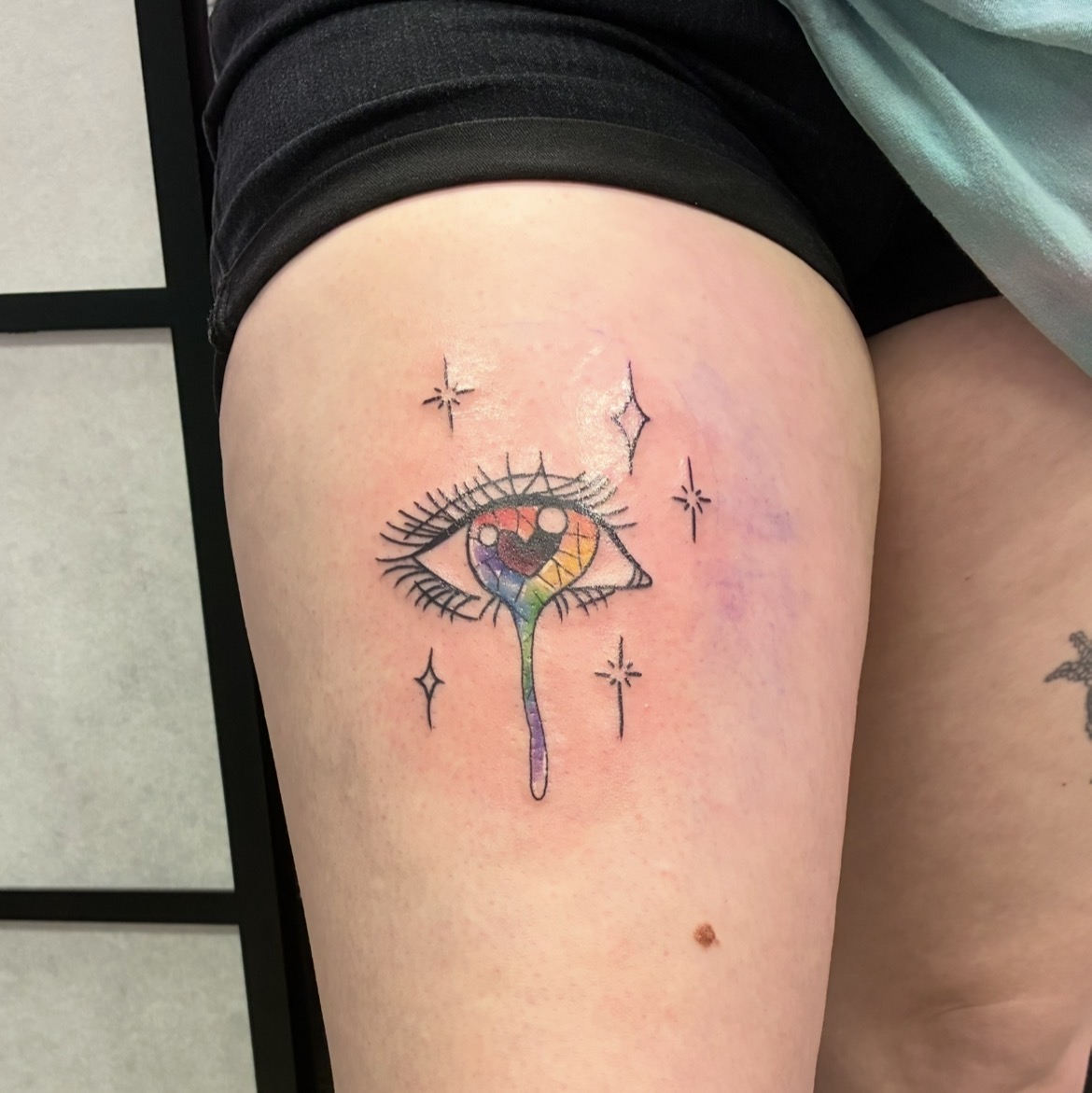 Eye